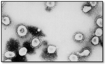 新型コロナウイルス（SARS-CoV-2）（CDC/Getty Images）